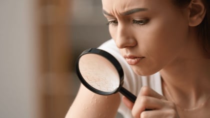 What to Know About Your Skin Barrier and How to Protect It