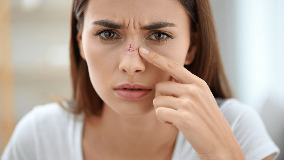 Nez sec en été : comment soulager une muqueuse irritée ?