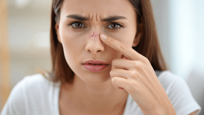 Nez sec en été : comment soulager une muqueuse irritée ?