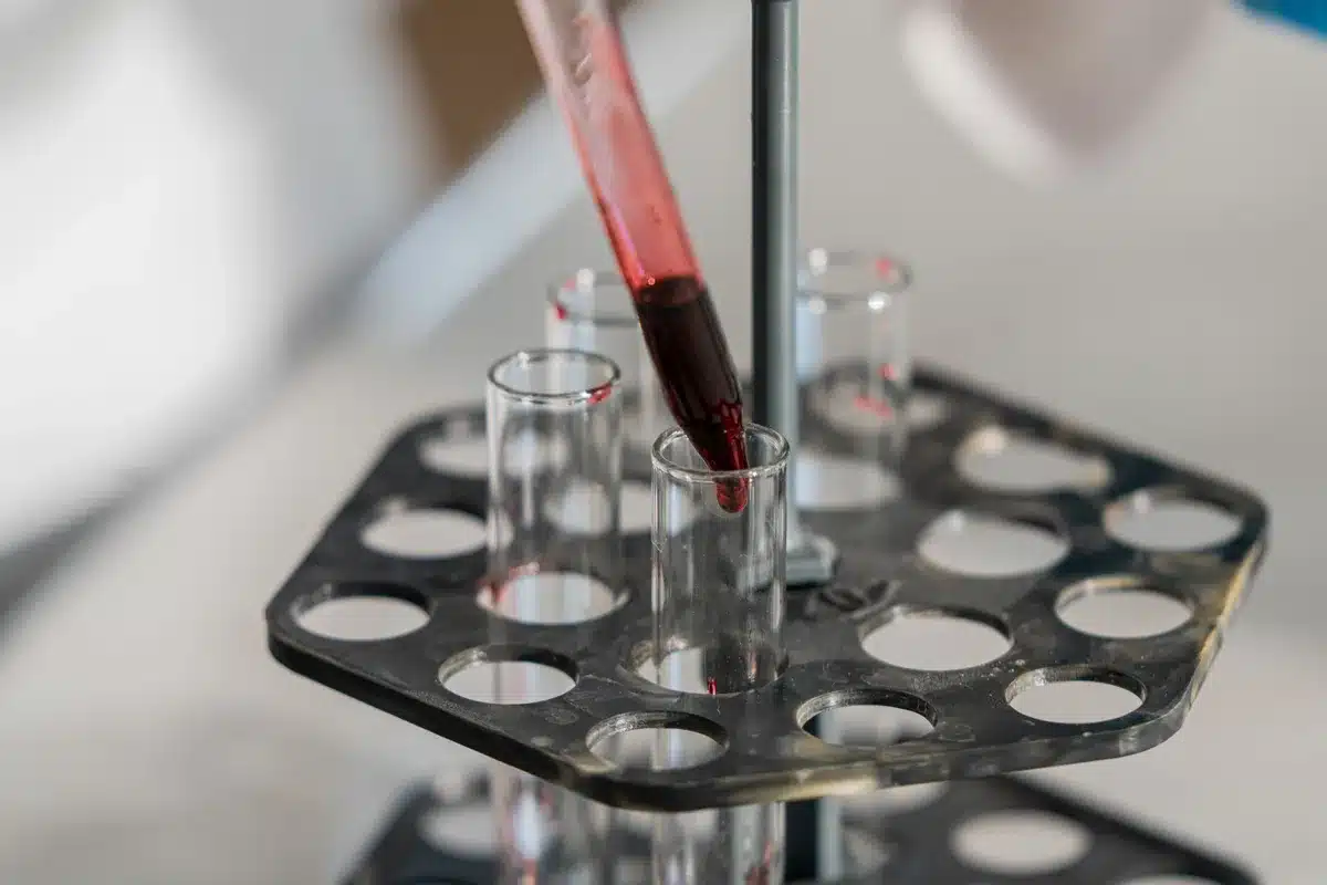 Pr&eacute;l&egrave;vement sanguin en laboratoire pour analyse g&eacute;n&eacute;tique
