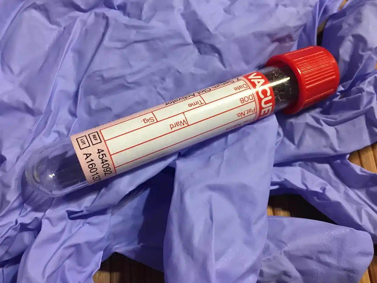 Tubes de centrifugation contenant du plasma sur un plateau en clinique